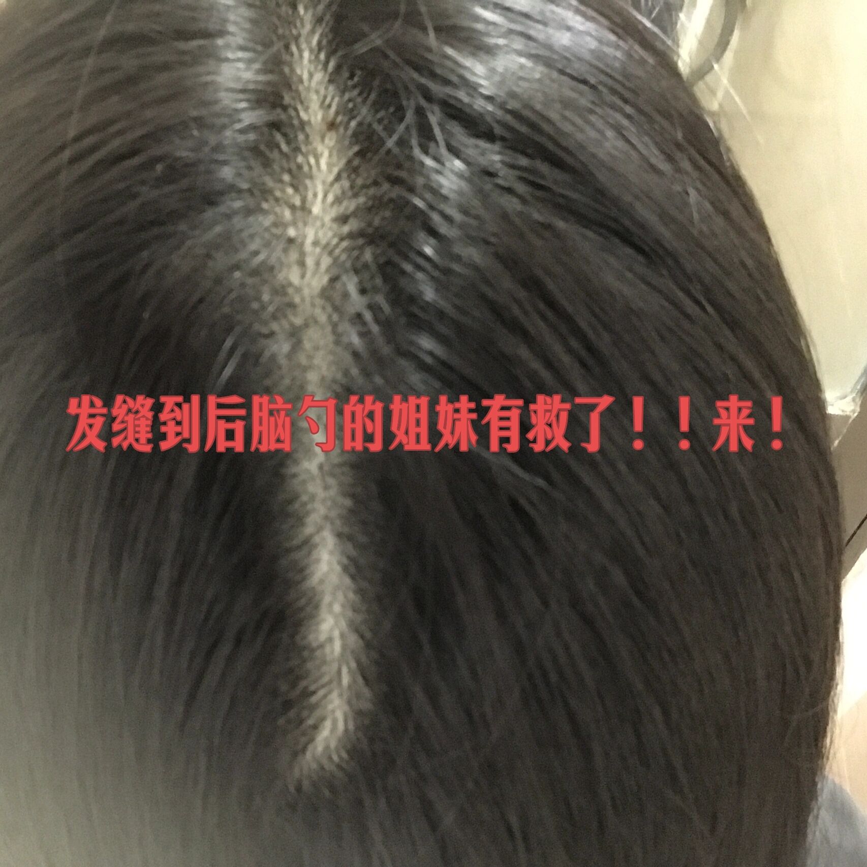 撑开毛都没长齐的小缝撑开毛未长齐的小缝-第1张图片