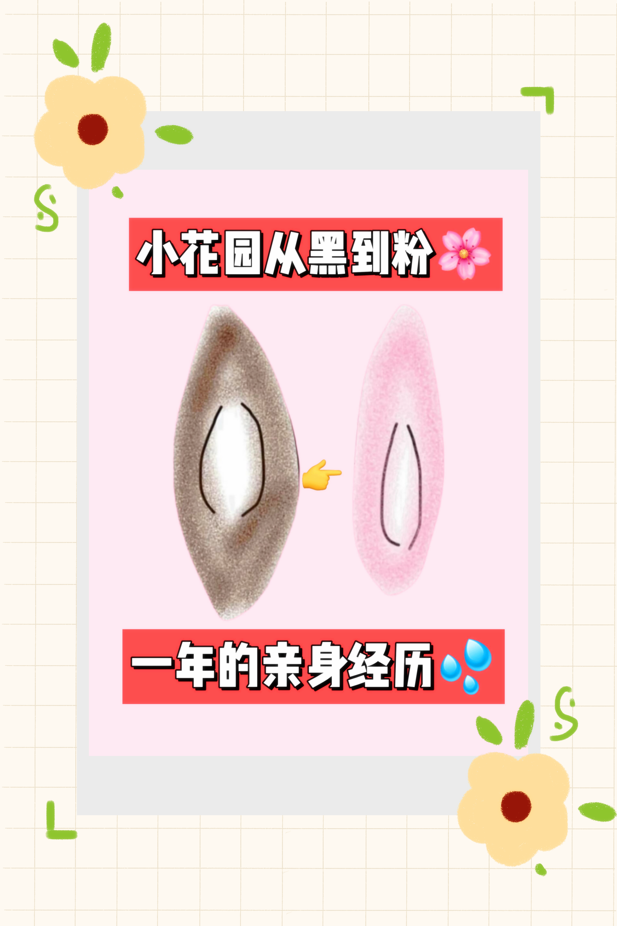 他趴在两腿中间添我私密有事吗他趴在两腿中间添我私密，是否有问题？-第1张图片