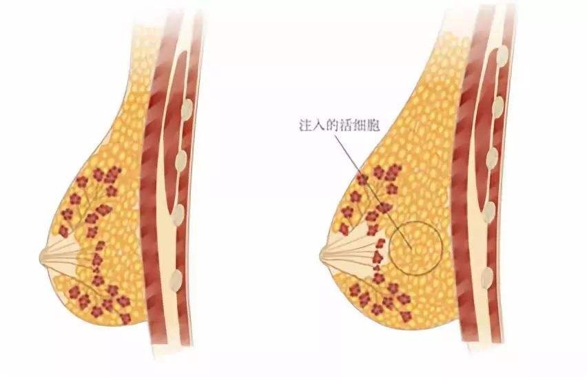 日本lachouchou丰胸膏日本Lachouchou丰胸膏，重塑自信的秘密武器-第3张图片