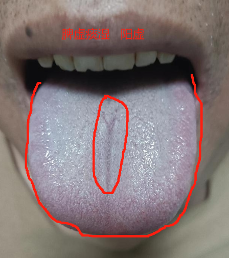 把舌头放屁眼里是感觉