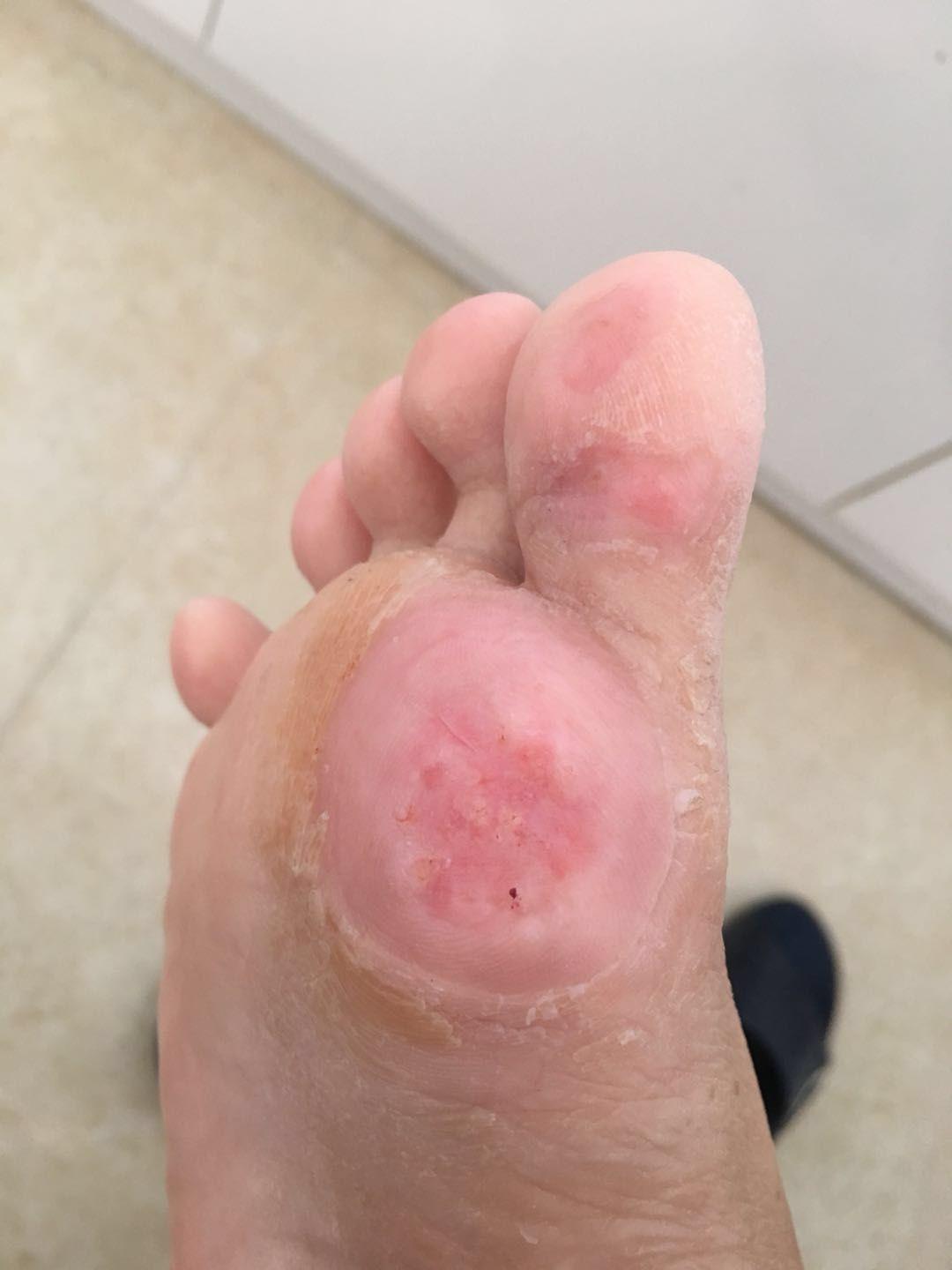 太粗了好痛快拔出去-第2张图片