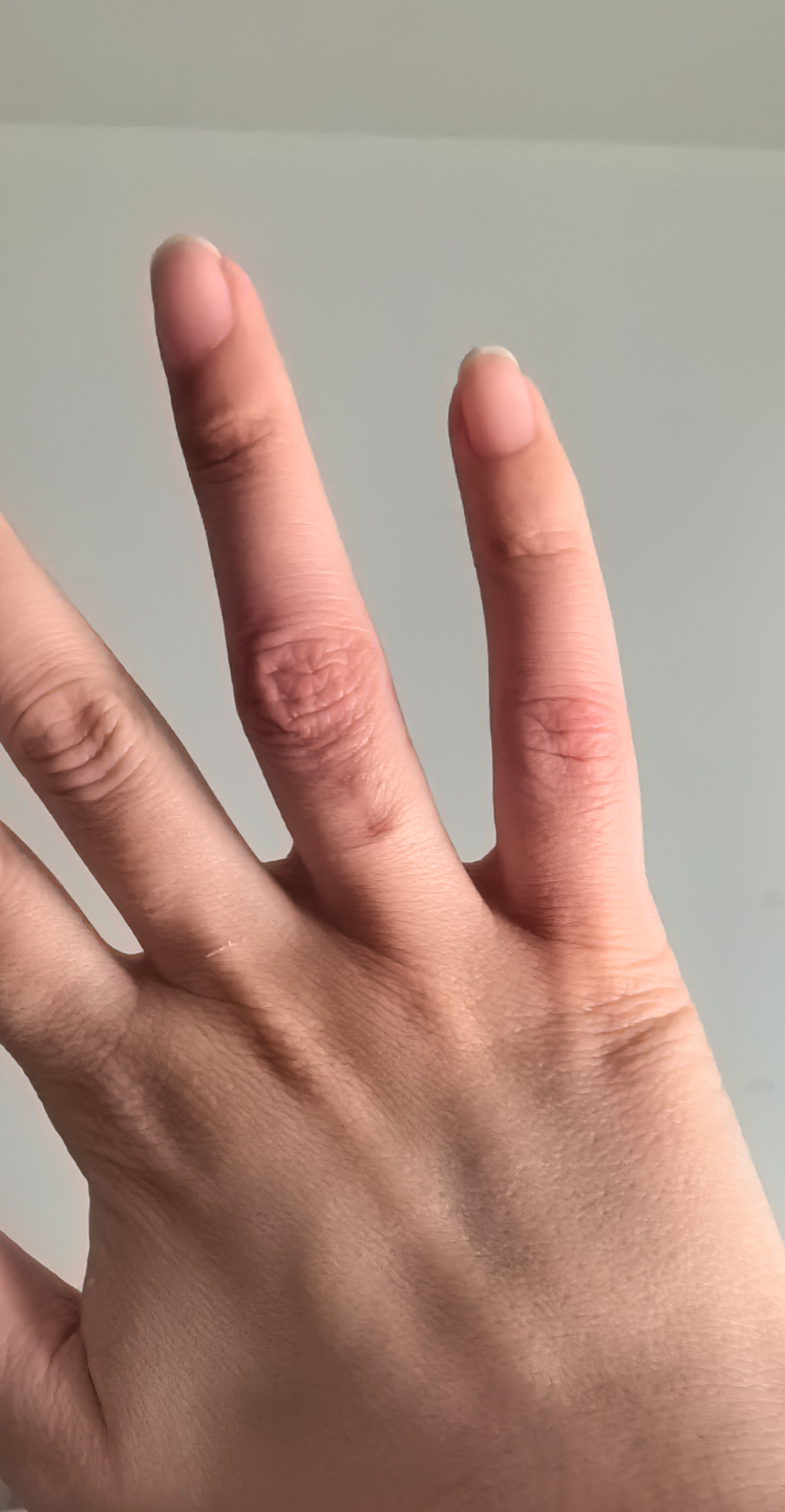 三根手指就受不了了，怎么办？-第3张图片