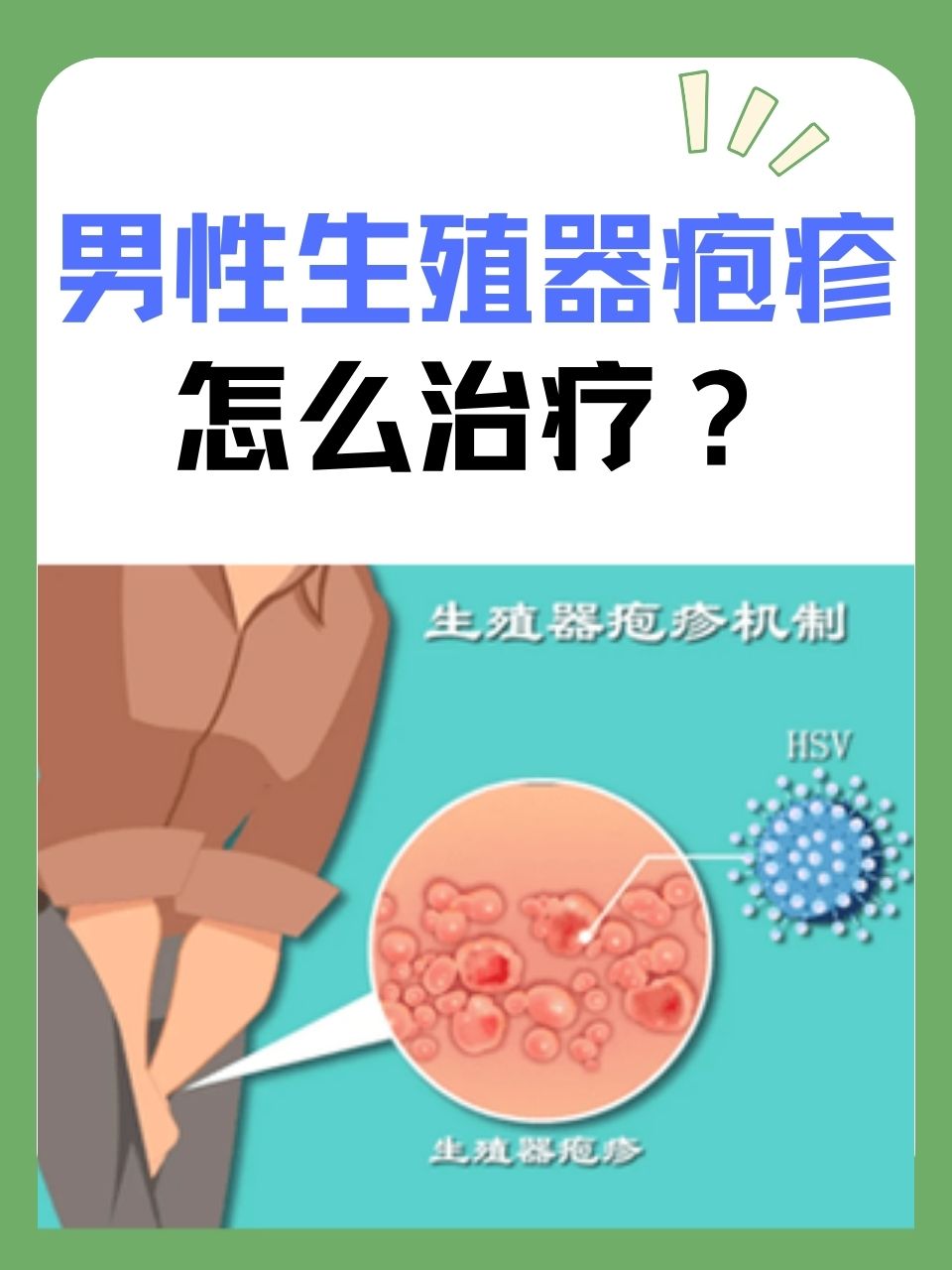 男性得了性疾病有哪些症状图片性图片，揭示的诱惑与禁忌