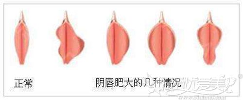 欧美肥大BBBBBBBBB欧美肥大BB-第1张图片