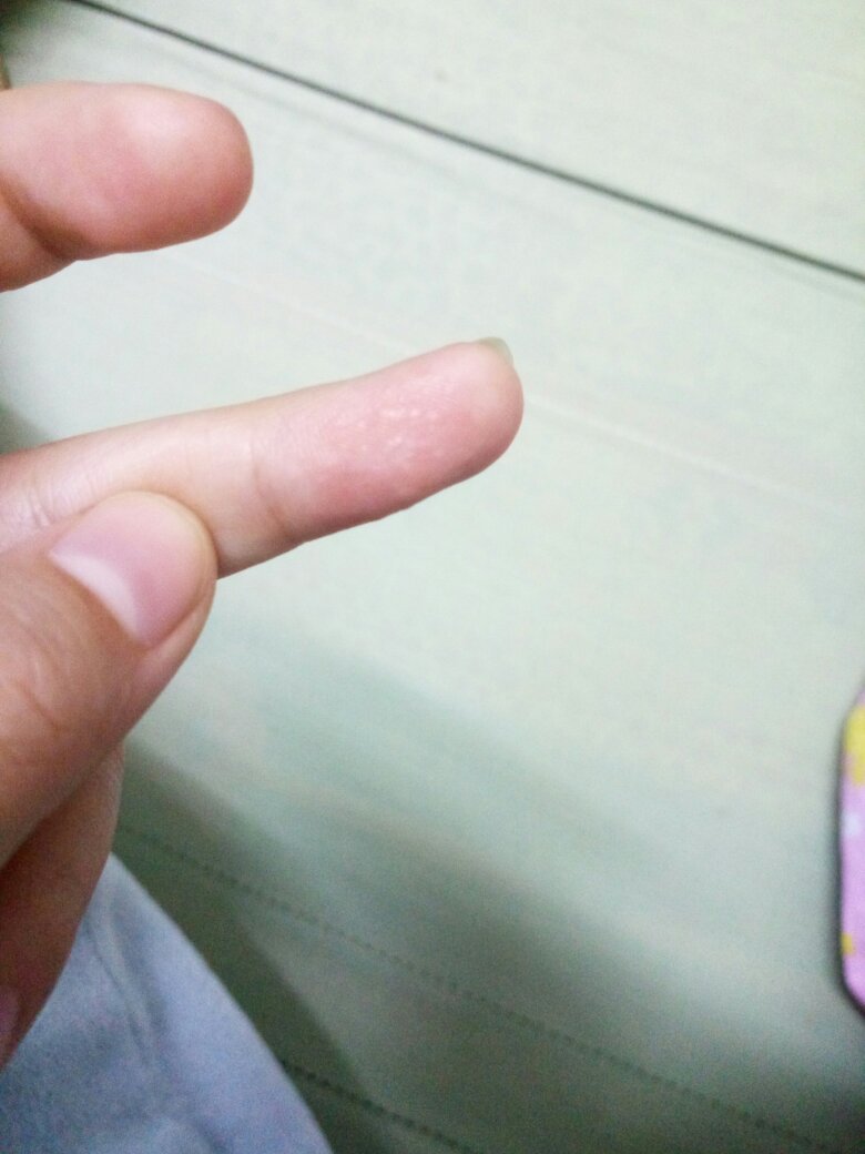 技巧教你揉小豆豆喷水视频技巧教你揉小豆豆-第1张图片